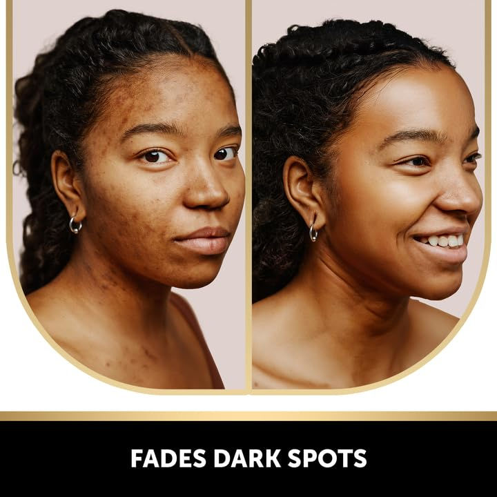 Thumbnail: Valitic Kojic Acid Dark Spot Remover