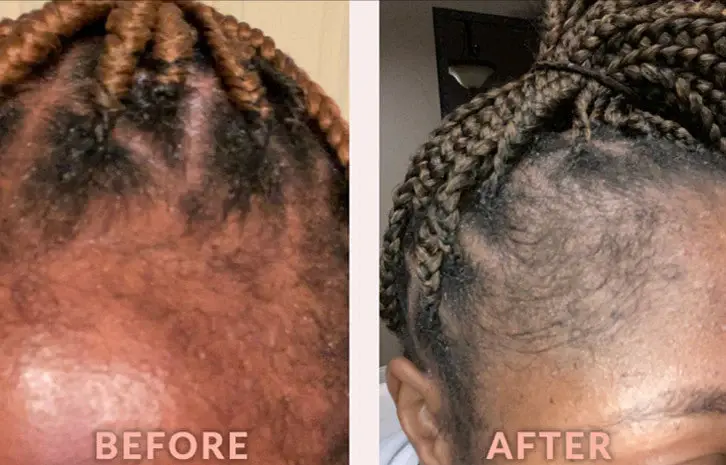 Thumbnail: Design Essentials Edge & Temple Strengthening Oil