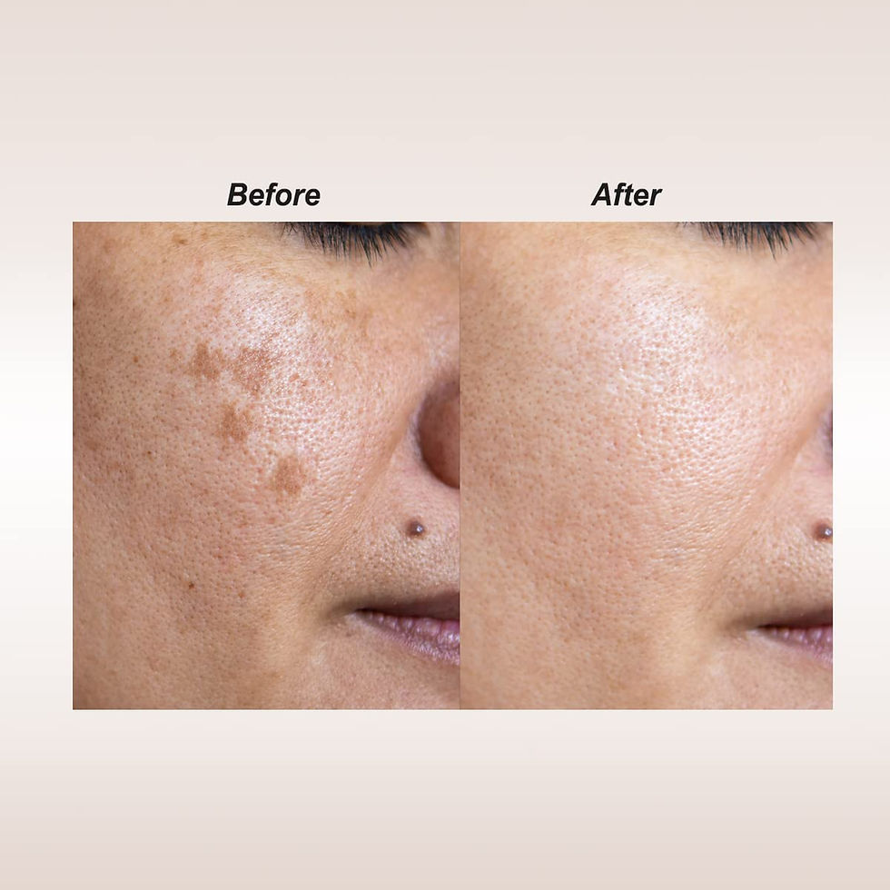 Thumbnail: Dalfour Beauty Vitamin C + Chromabright