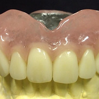 Close-up of a dental prosthesis with white teeth and pink gums