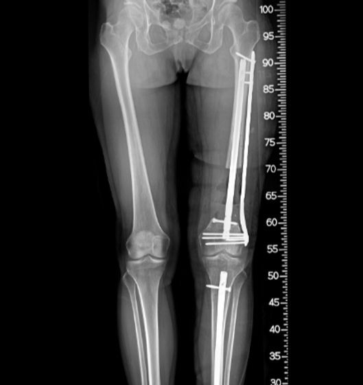 F_LEG_20250626_165202_edited.png