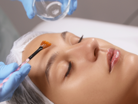 chemical peels in a spa setting