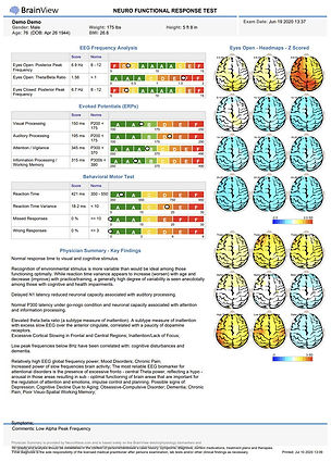 BrainView QEEG Brain Map report