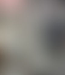 GyroStim Therapy: Improve Vestibular Dysfunction & Enhance Athletic Performance