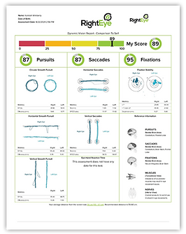 RightEye Vision Report