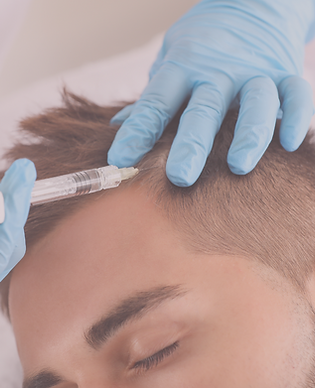 tratamento para calvície.png