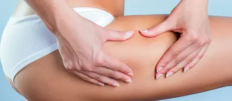 Gli inestetismi della cellulite e gli approcci migliori per contrastarli