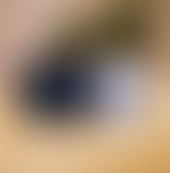 Photobiomodulation et MILTA PAD : une lumière au service de la régénération naturelle