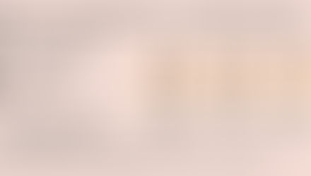 How Laser Hair Removal Works & Why Consistency is Key