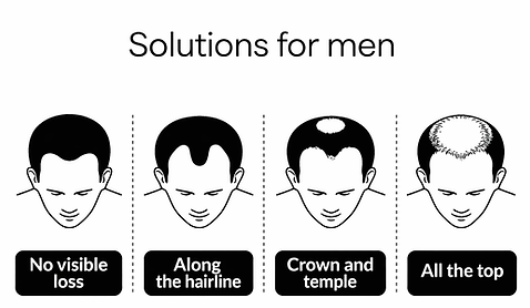 Mens Hair Services The Gallery Wigs Hair Enhancement Studio
