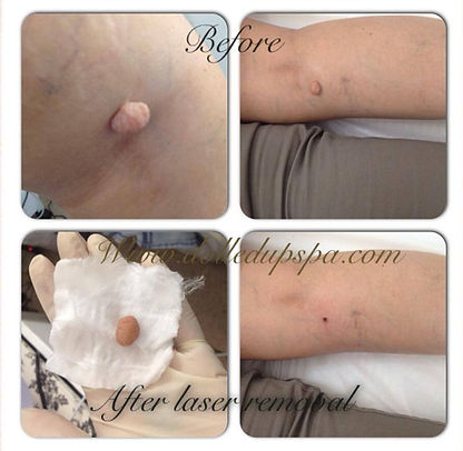 Edited Image 2016-04-30 04-43-32