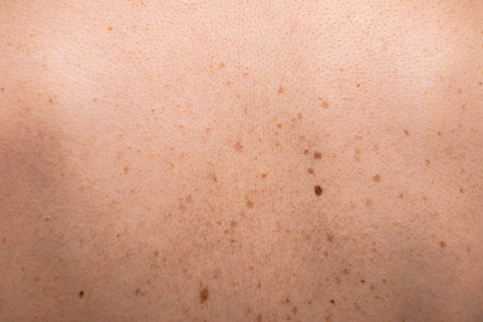 Skin closeup