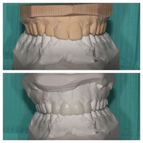 How will my final dental restoration look like?