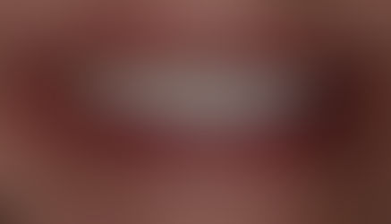 The Transformative Power of a Beautiful Smile: How it Impacts Your Life