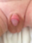 Circumplast