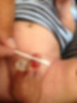 Circumplast