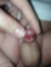 Circumplast