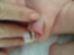 circumplast day 6