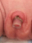 Circumplast day5