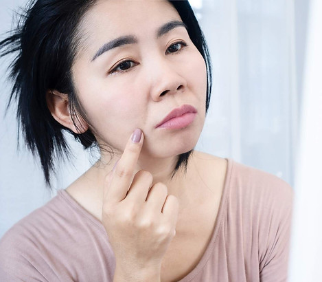a woman looking sad into the mirror at her deep nasolabial fold