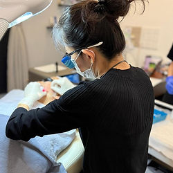 Endolift procedure to remove eye bags at Dr Jane Clinic