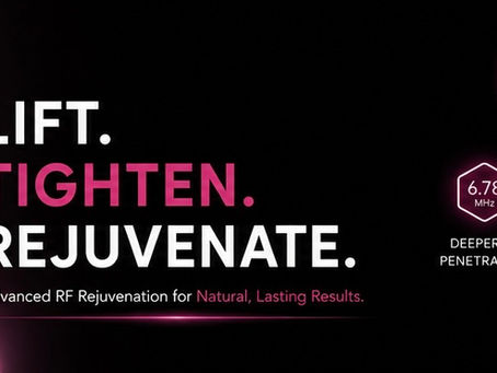Volnewmer non-invasive radiofrequency treatment