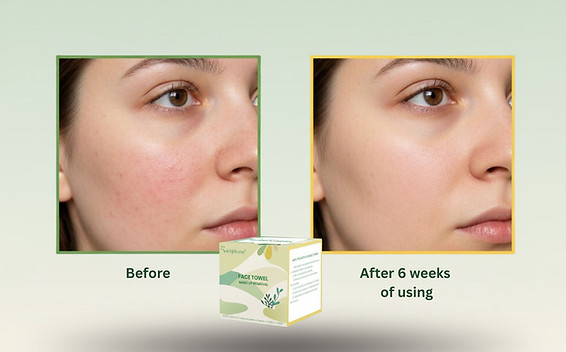 makeup remover towel