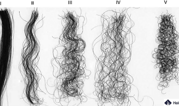 the-types-of-hair.png