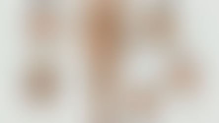 Common VA Functional Loss & Limitations for Joint Conditions