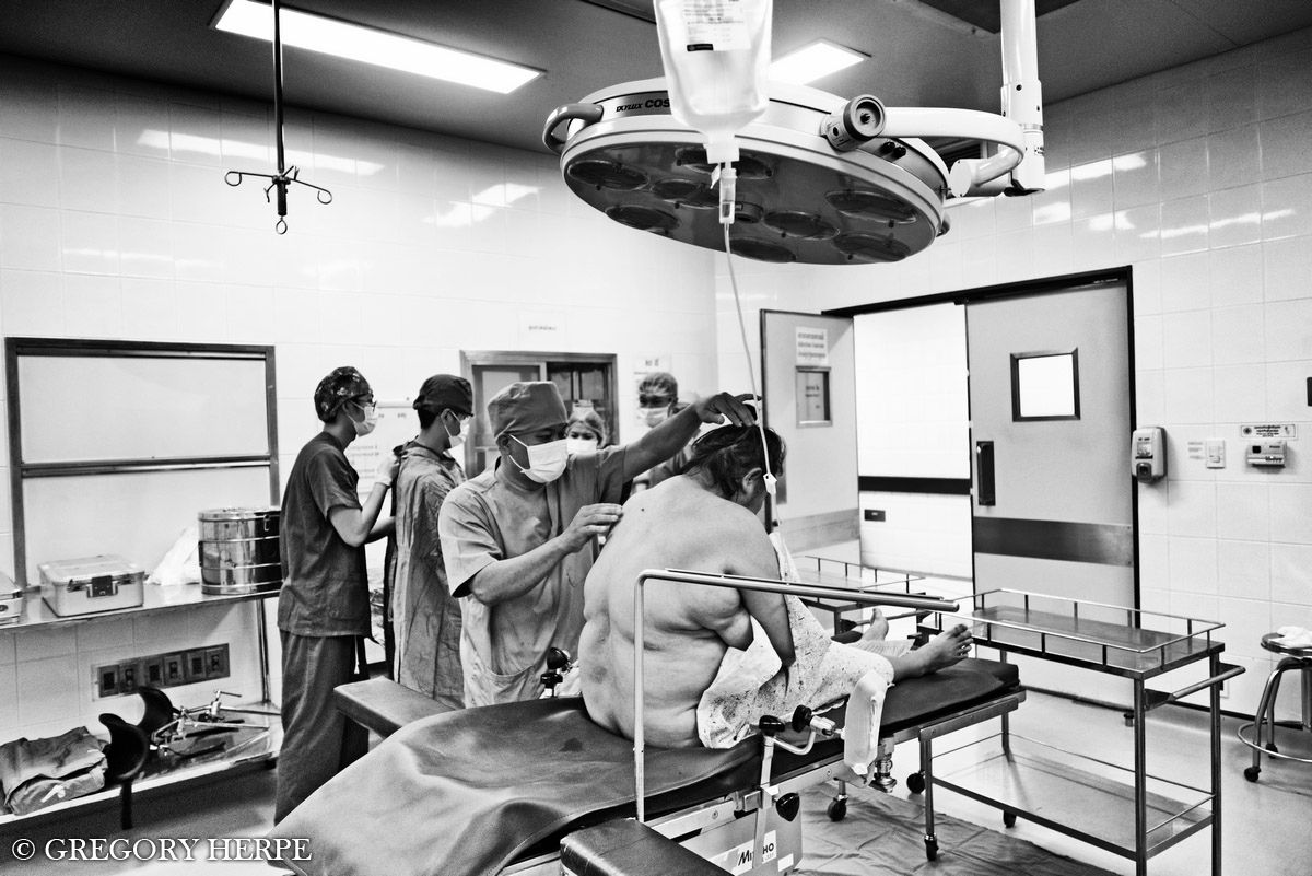 Spinal Anaesthesia