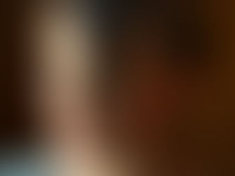 What is PCOS and Hair Loss?🌿