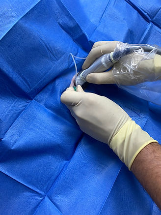 UltrasoundProbe,nerveblock.jpg
