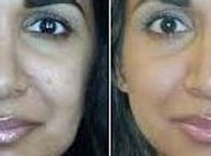 Revitalizing Cream Peel Photo.jpg