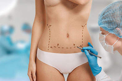 woman-marked-out-cosmetic-surgery.jpg