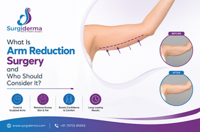 What Is Arm Reduction Surgeryand Who Should Consider It?