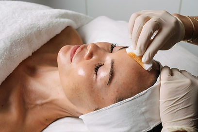 ChemicalPeel-scaled.jpg