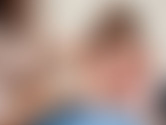 Psoriasis Treatment for Children: What Parents Should Know