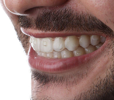 WhatsApp Image 2021-01-13 at 20.36.46 (3).jpeg