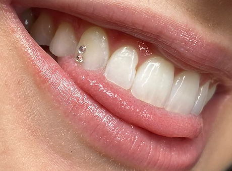 Toothgem.jpg