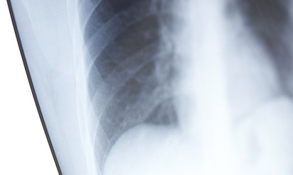 X-Ray