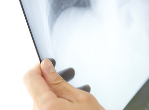 radiographie