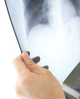 X-Ray