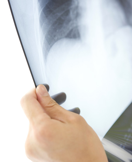 radiographie