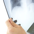 X-Ray