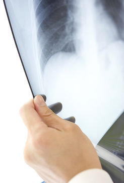 X-Ray
