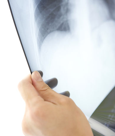 X-Ray