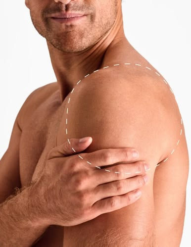 Laser Hair Removal Shoulders _ Laser Clinics Canada.jpeg