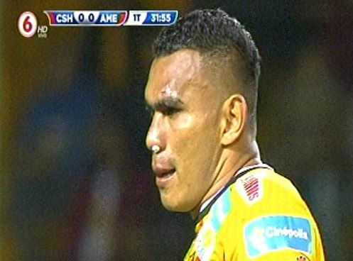 Cristian Lagos golpe.jpg