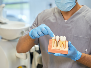 What Are Dental Implants? And How Do They Work?