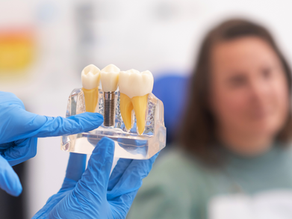 Are Dental Implants Safe? Your Questions Answered